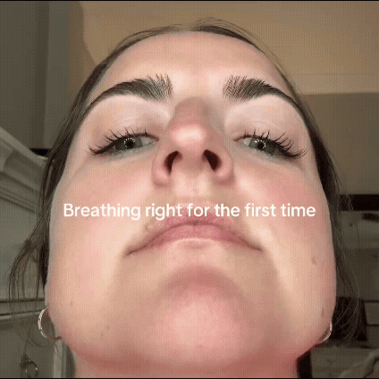 Anti-Snoring Magnetic Nasal Strips 